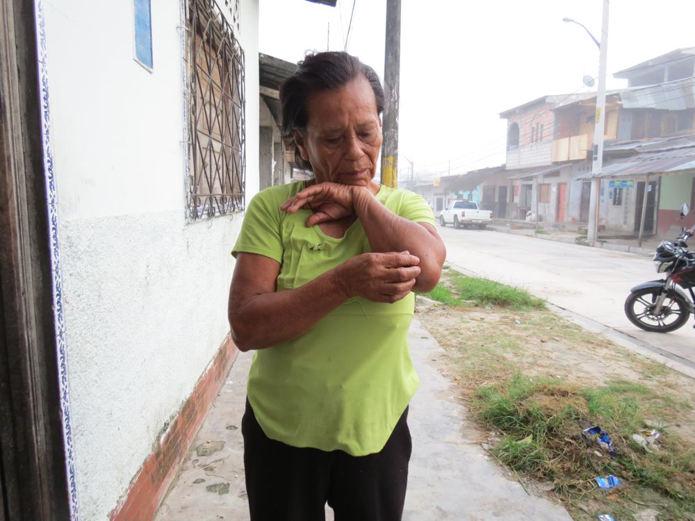 Abuela golpeada