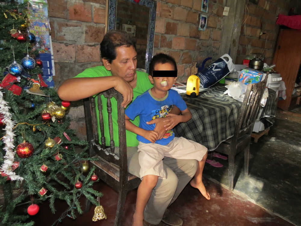 Perro desfigura a niño