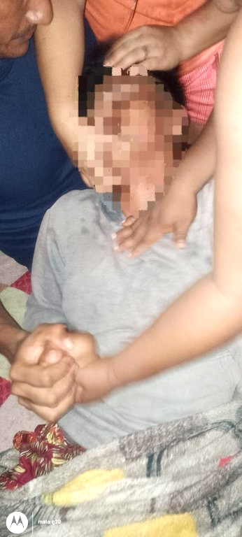 Adolescente resulta herido tras impacto de rayo