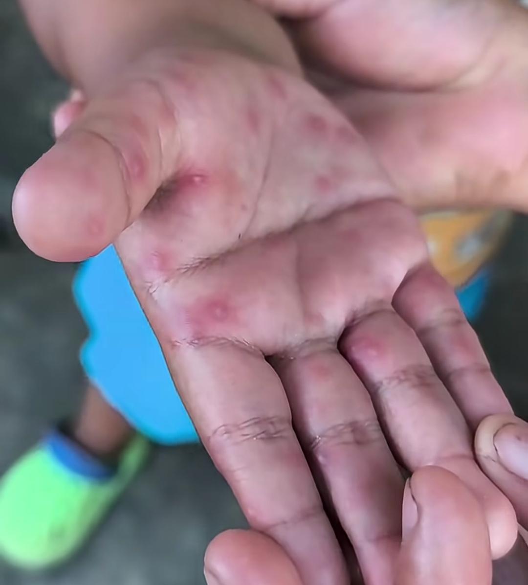 Madre pide atención para su hijo